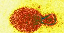 Nou virus a la Xina: 35 contagiats per Henipavirus